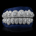 Iced VVS Moissanite Grillz with Large Center Stone